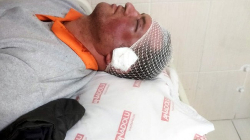 Kdz. Ereğli'de, Temizlik İşçisine Vahşi Saldırı!
